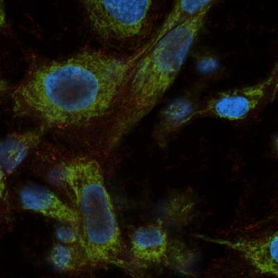 Mitochondrial DNA-damage