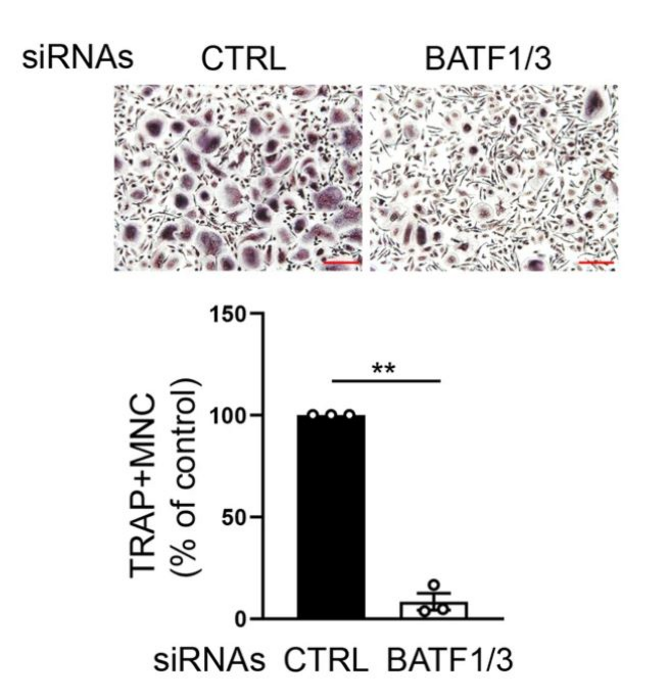 Immunoblot analysis of NFATc1 expression