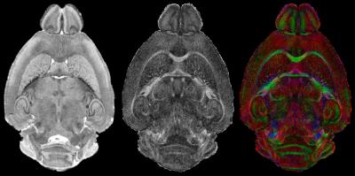 Mapping Desired Matter in Brain