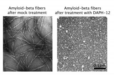 Dismantling Alzheimer's Disease