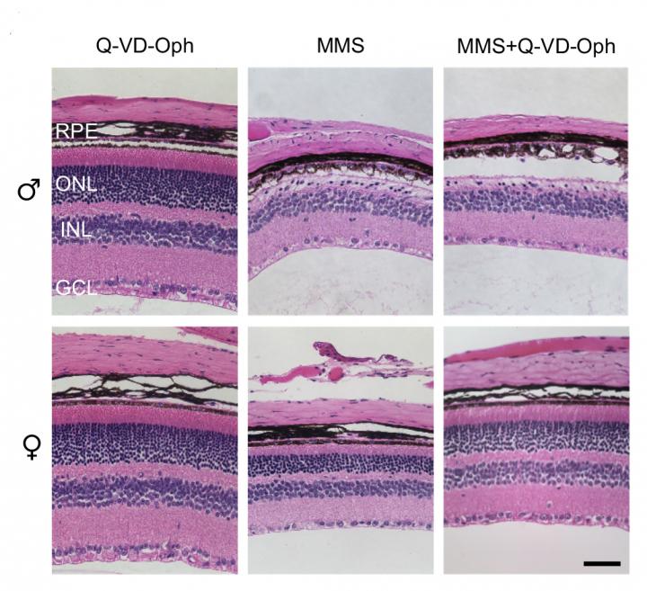 Tracking Down the Culprits in Chemotherapy-Induced Retinal Damage (2 of 2)