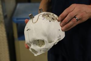 Feinstein Institutes’ bioelectronic medicine researchers hold a 3-D model of the skull
