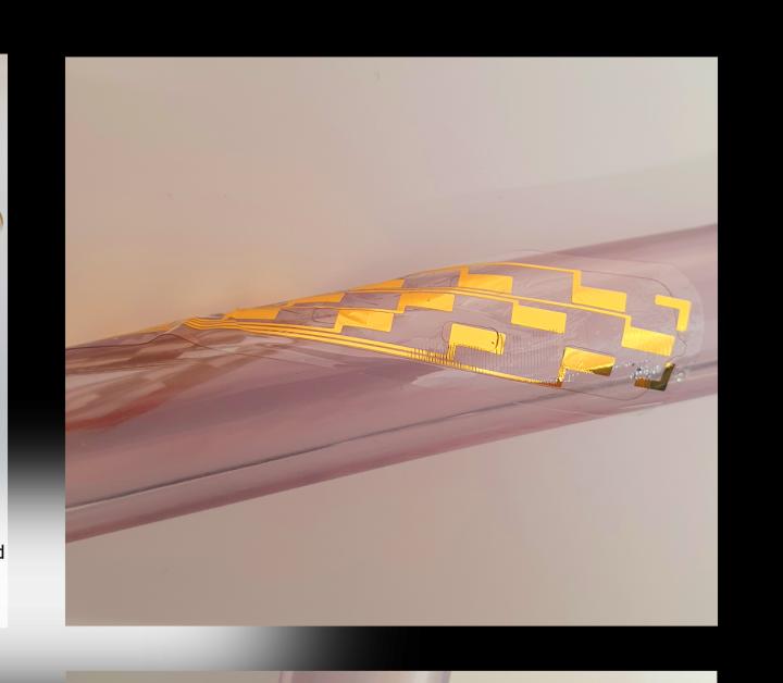 Tiny 'air mattresses' could help treat severe back pain