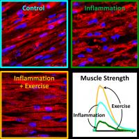 Inflammation and Exercise