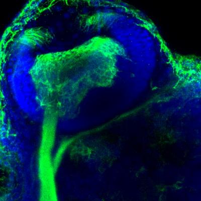 Eye of Zebrafish Embryo with Enlarged Ganglion Cell Layer