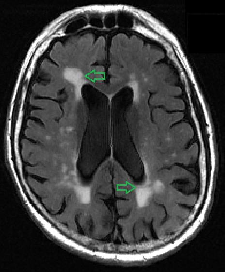 MRI Image 2 (for comparison)