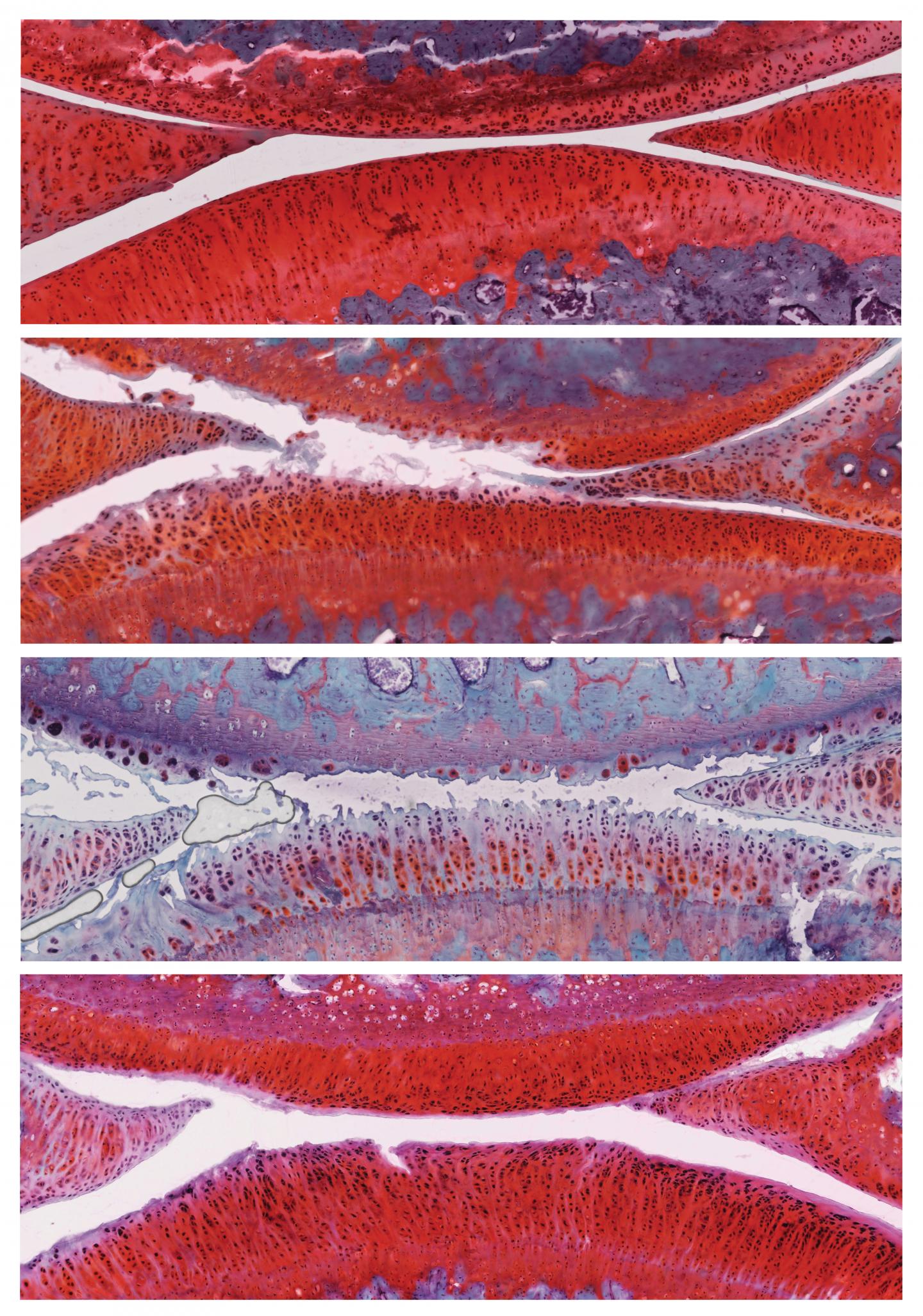 Salk Institute -- Belmonte Lab -- Osteoarthritis