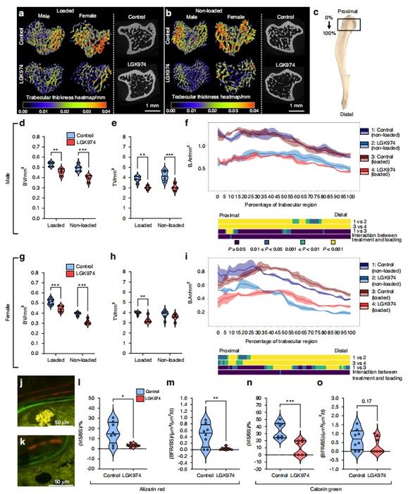 LGK974 treatment reduces tibial trabecular bone morphometric parameters in Sost-/- mice.