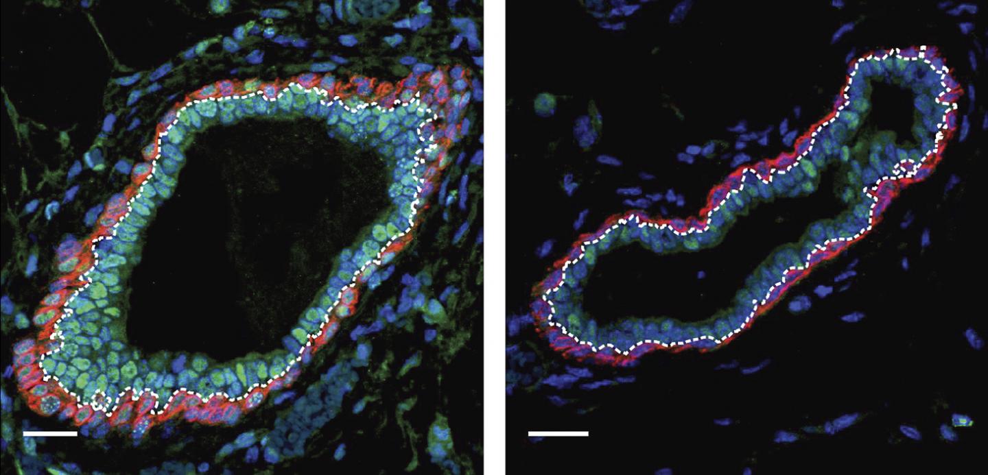 Decitabine Suppresses Luminal Progenitor Cell Expansion