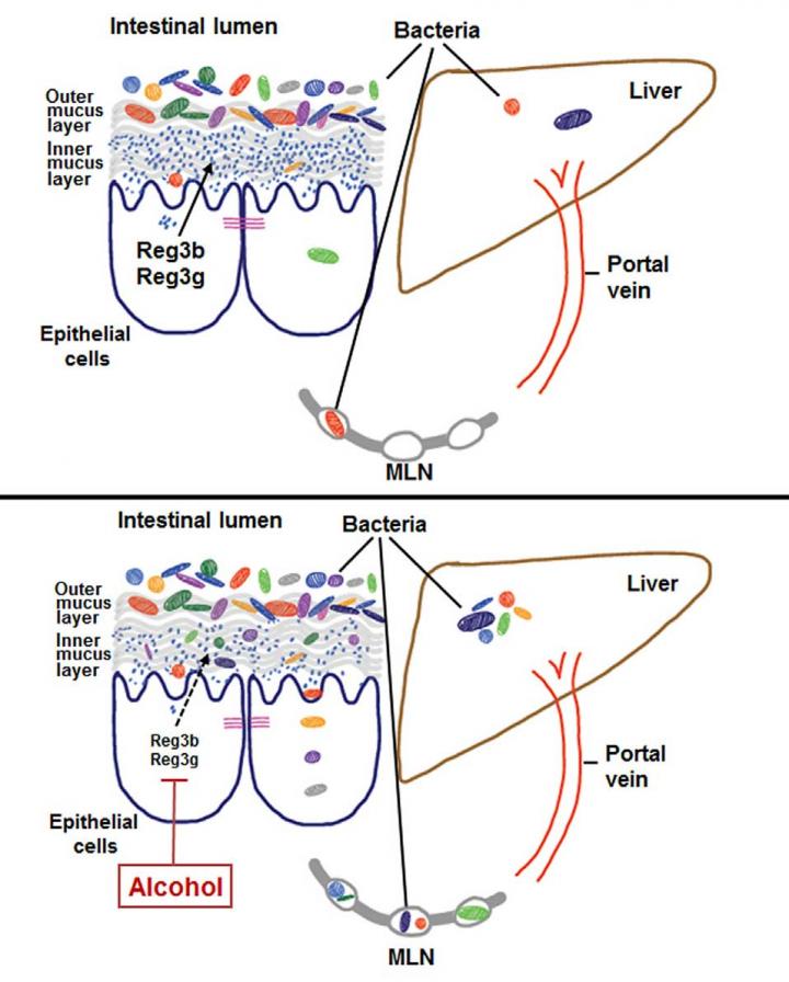 Chronic alcohol use helps bacteria harm the l EurekAlert!