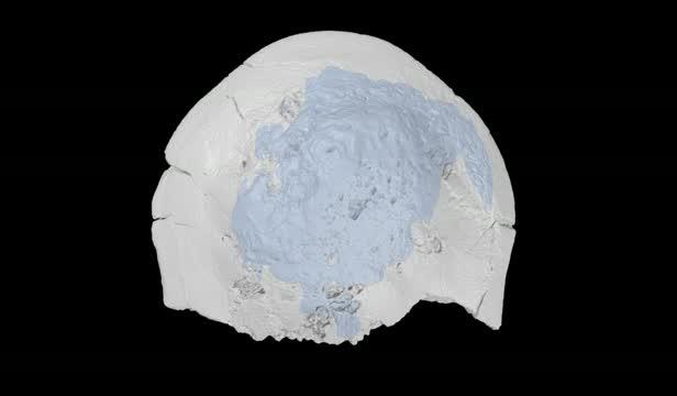 3-D Reconstruction of a 10-Million-Year-Old Sea Urchin