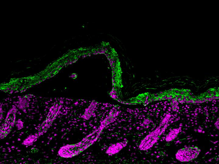 A fluorescent micrograph of a cross-section through an epidermal blister on mice skin