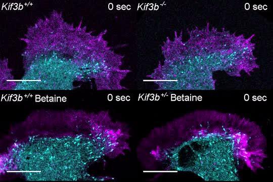 Development of neurons with and without genetic mutation associated with schizophrenia