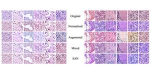 Tissue image datasets processed by stained SAN (bottom row) achieve color distributions that are more consistent than those processed using other techniques. Such consistency is essential when training machine-learning-based systems.