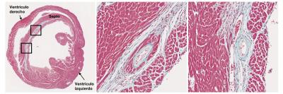 <i>Phyllorhiza punctata</i>