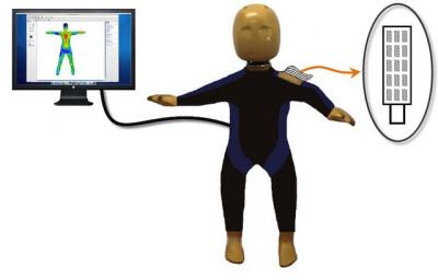 The Surrogate Bruising Detection System