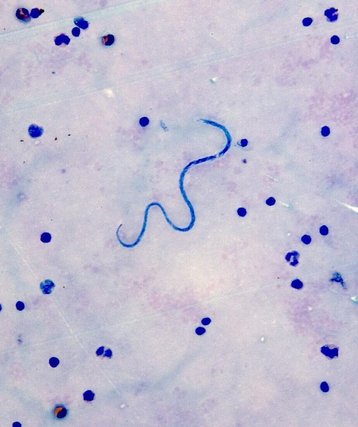 Mansonella Perstans Microfilariae In A Blood Smear