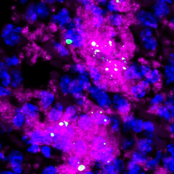 Tumors can drive thrombosis by releasing chemokines, secreted proteins that can circulate to the lung.