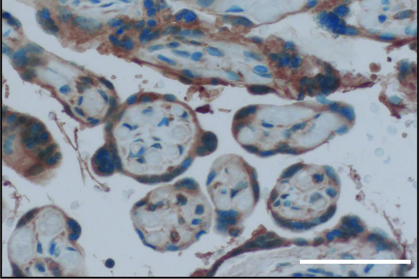GPER1 in Placental Cells