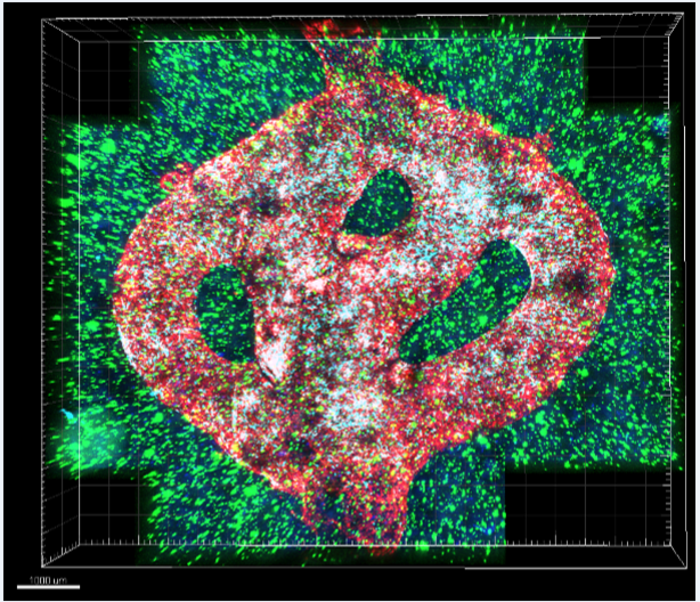 Microscopic image of the 3D-bioprinted glioblastoma model.