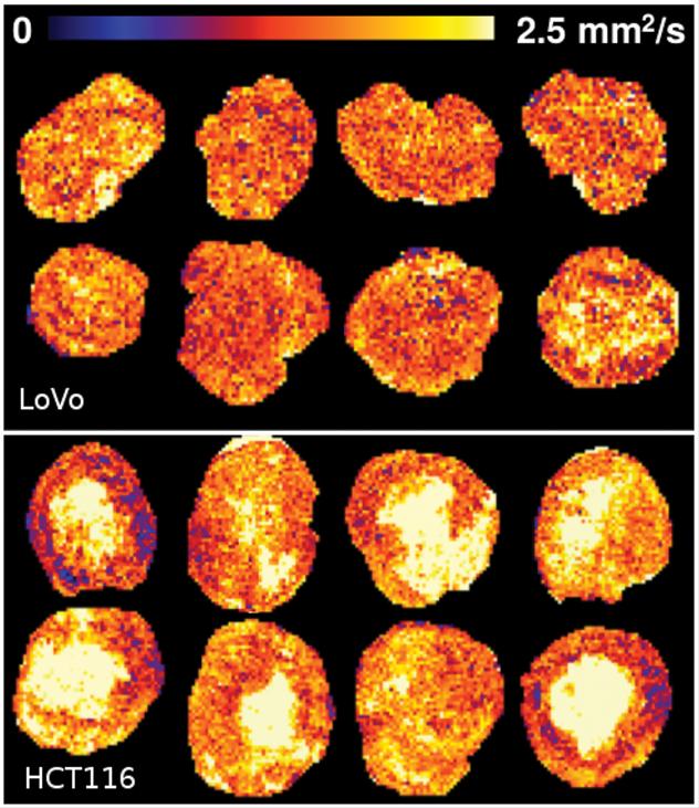 Technology Used to Map Mars Now Measuring Effect of Treatment on Tumors