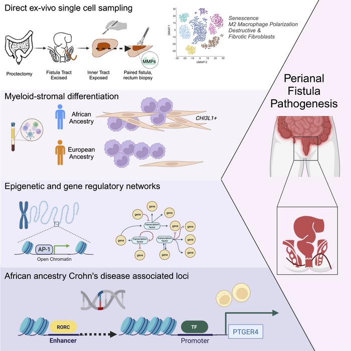 graphical abstract-abnormal tissue tunnels in Crohn's disease