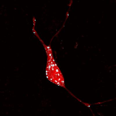 Neuron Cell Body