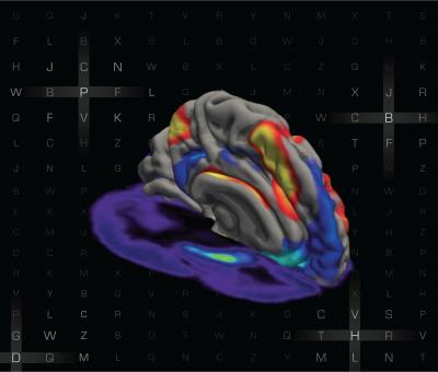 Simultaneous MRI and PET Images Showing Interaction between Brain Networks