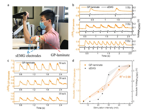 Fig. 3 Monitoring of electrically evoked biceps muscle contractions by GP-laminate and sEMG.