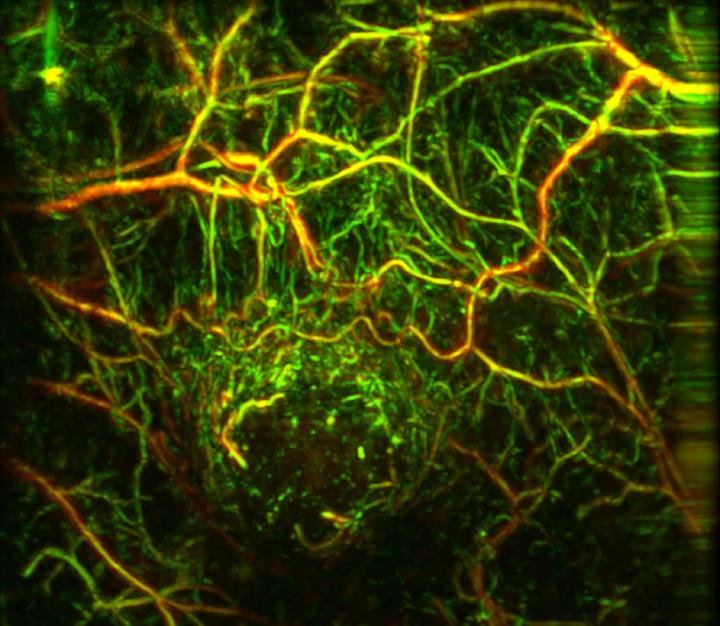 MSOT Picture of Tumor