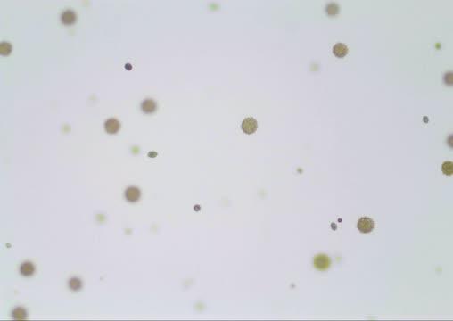 An Abundance of Microscopic Yellow-Green "Balls" Rolling Through Water Collected from a Lake