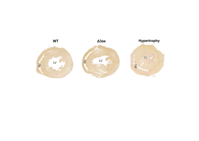 ventricle