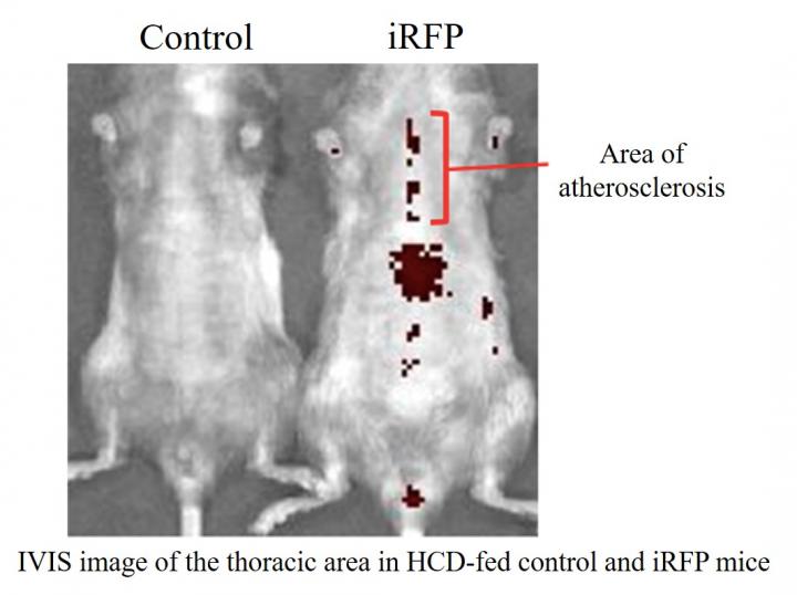 Improved In Vivo Imaging of Atherosclerotic Plaque Development