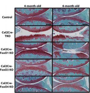 Proteins that Maintain Healthy Cartilage May Help 'Outfox' Osteoarthritis (1 of 2)