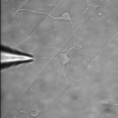 RNA to Reprogram 1 Cell Type into Another