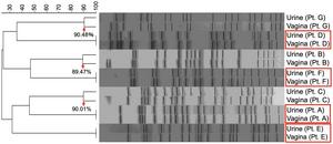 High genetic similarity in pathogenic E. coli isolated from urine and vagina of women with recurrent cystitis