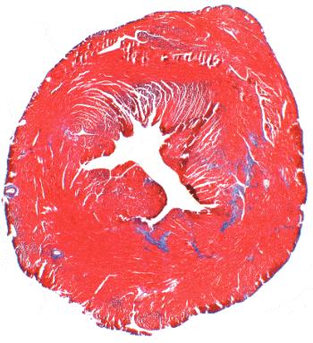 Seeking a Way to Keep Organs 'Young'