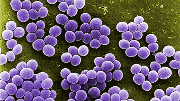 Staphylococcus aureus microbes