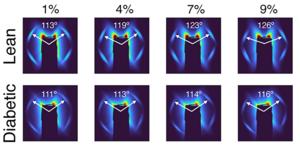 Comparison of X-ray scattering patterns between a representative disc from each group