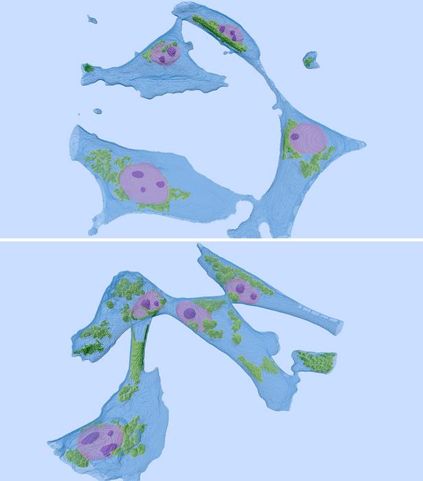 Breast cells - normal and cancerous