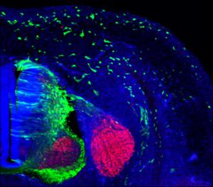 The ZIC2 gene drives the migration of neural crest cells in embryonic stages