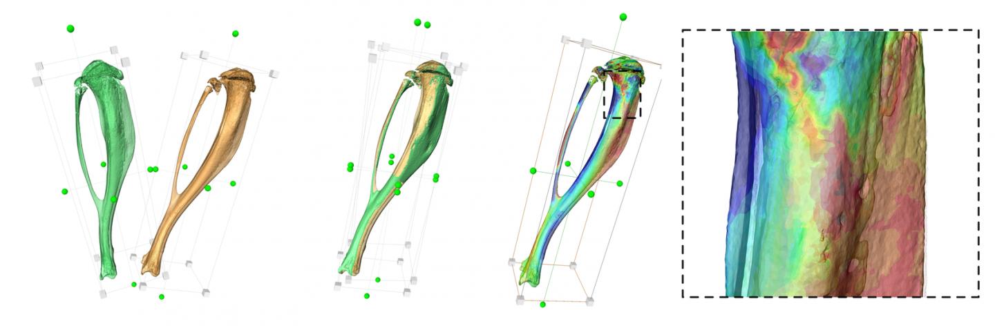 Structural Bone Changes