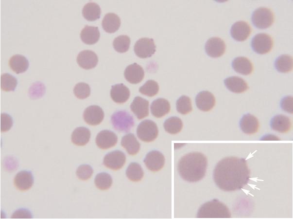 Blood Smear