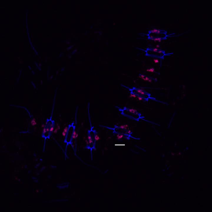 Chain of Diatom Cells