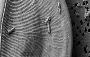 Electron Micrograph of the Major Antarctic Sea Ice Diatom <i>Amphiprora</i> with Attached Bacterial 