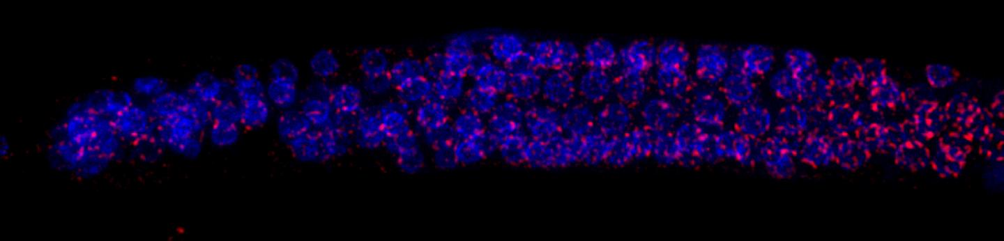 PIWI and piRNA Staining