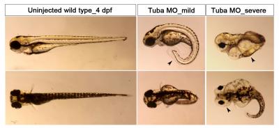 Aberrant Phenotypes Resulting from Tuba Knockdown in Zebrafish