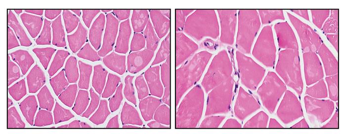 Cross-section of mouse muscle showing the size of muscle fibers.