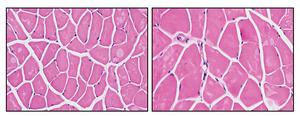 Cross-section of mouse muscle showing the size of muscle fibers.