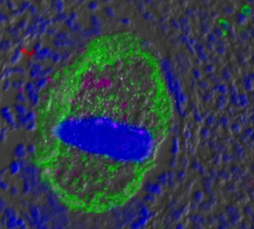 Fish Immune Response to Pathogens through Gills